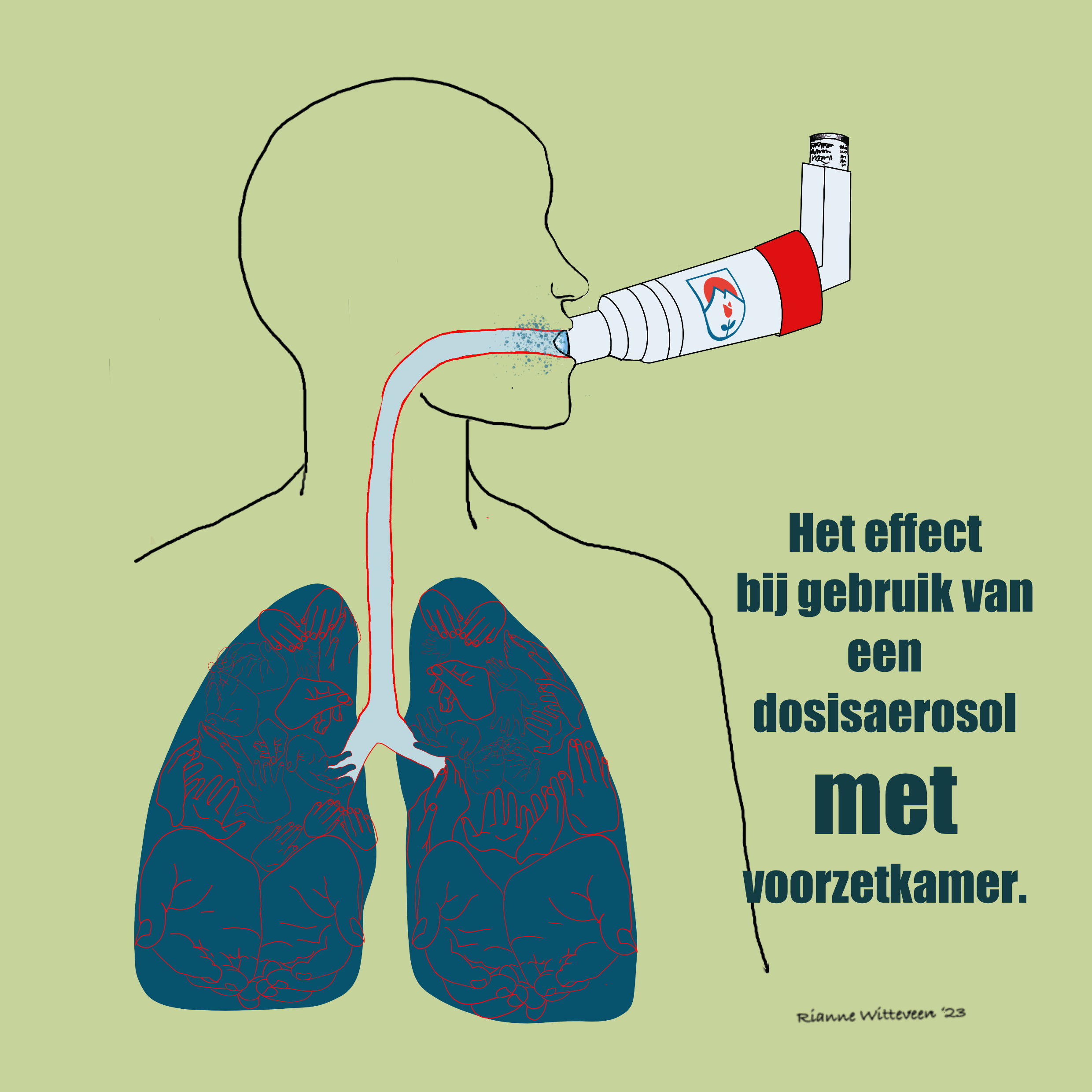 Inhalatiemedicijnen - Voorzetkamer effect